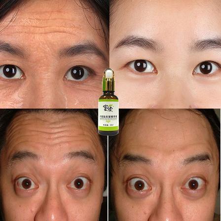 玻尿酸精華液1% Hyaluronic Acid